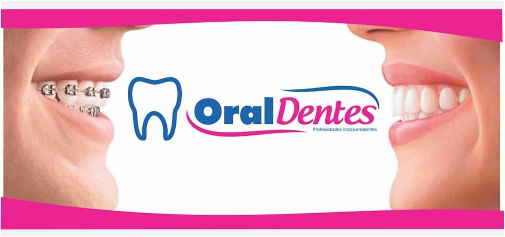 Oral Dentes